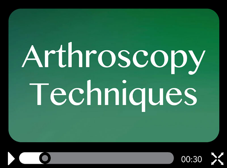 Arthroscopy Techniques