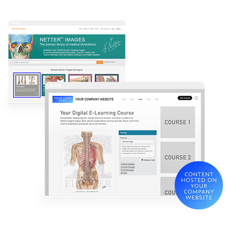 A sample of netter images hosted on medical websites.