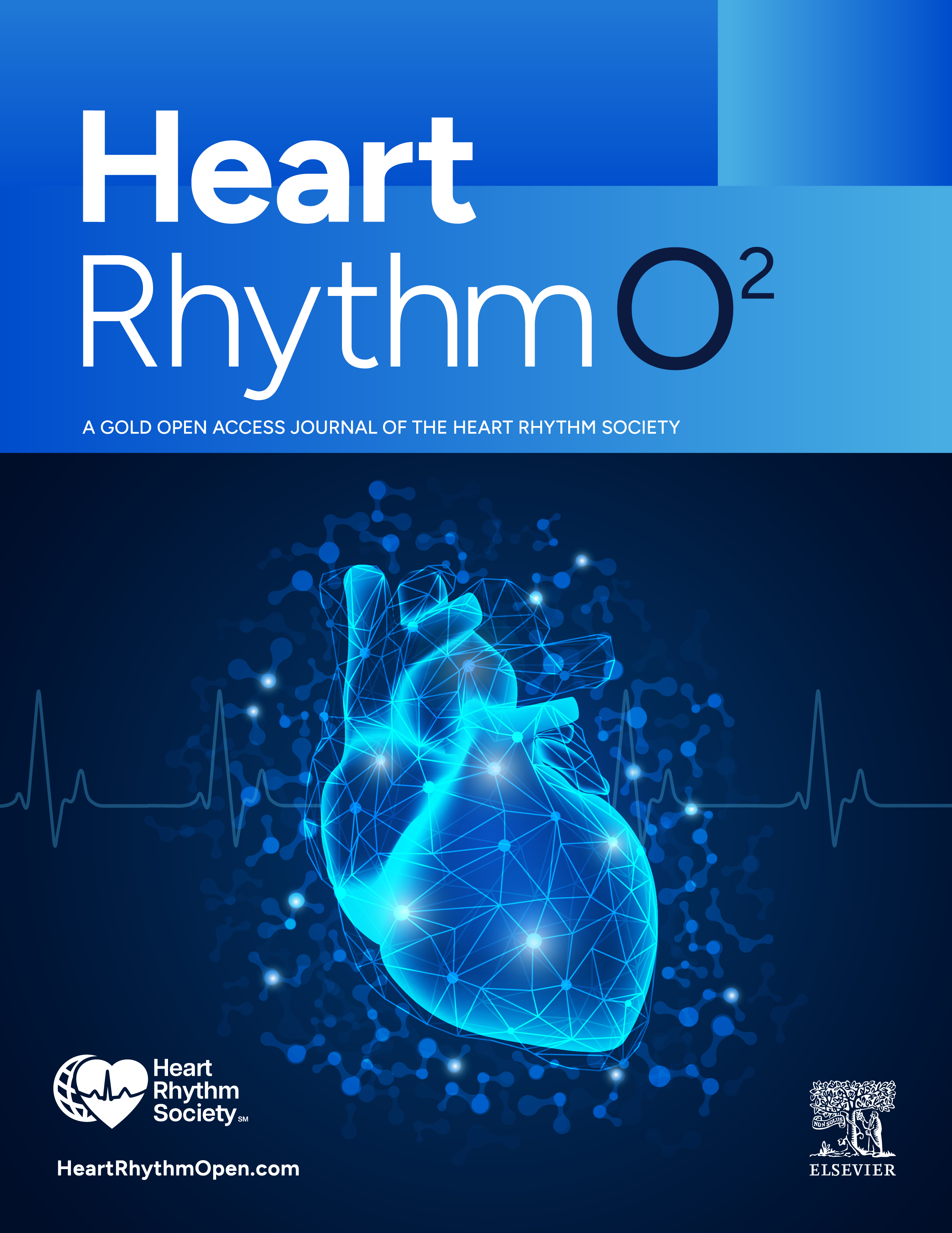 Heart Rhythm O2 